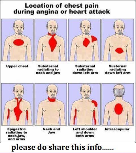 Newport Cfr Group Pa Twitter Pain From A Heartattack Or Angina Is Not Always Central Chest Pain As This Pic Shows Know The Signs Symptoms Http T Co 9ichunbvfp