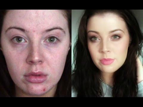 makeupstyling's tweet image. My Full Coverage Foundation Routine (Acne) | MyMakeupPerspective vid.staged.com/6tHo #makeup #cosmetics