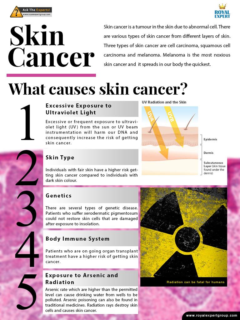 RoyalExpertGrp's tweet photo. What are the causes of #SkinCancer ?

https://t.co/cwRdsUjGAK
https://t.co/i7QEQ1Zh5e
http://t.co/Um0l3a1F1I http://t.co/5frXVaoSOd