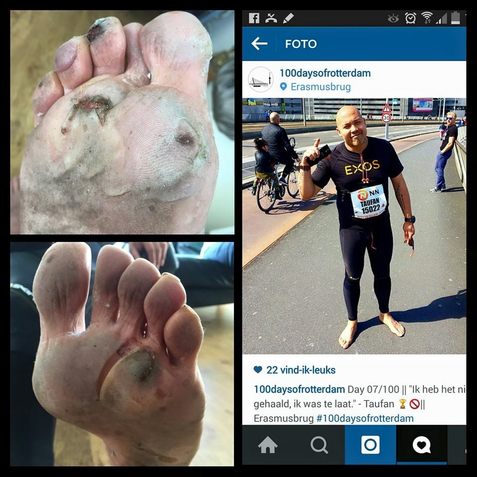 Helaas, in glas gestapt. Volgend jaar een nieuwe poging! blootsvoets <a href="/MarathonRdam/">NN Marathon Rotterdam</a>