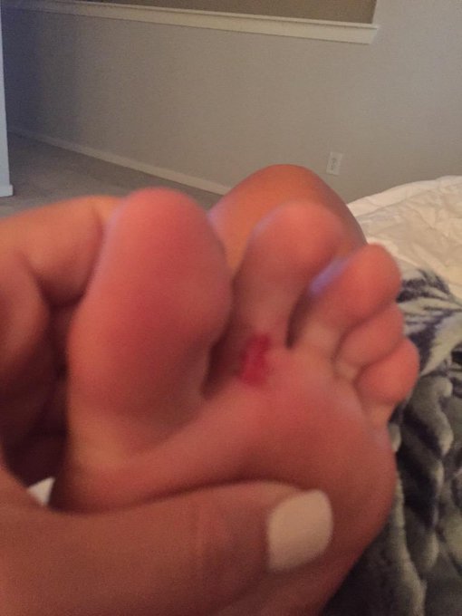 Forgive me loves but need some major sleep. My foot is killing me thanks to a lovely blister... 😳🙀 http://t<a href="/tag/longday"class="tags"><span>#longday</span></a><a href="/tag/doinwerk"class="tags"><span>#doinwerk</span></a><a href="/tag/gimmiecaffeine"class="tags"><span>#gimmiecaffeine</span></a>