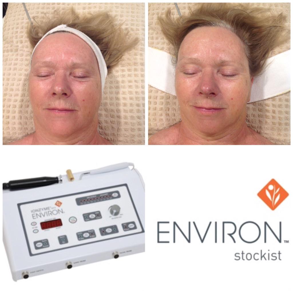 ByEnviron's tweet photo. Amazing results after 1 treatment! Reduced redness, plumper, Lines reduced around the eyes! Another Happy client :-) http://t.co/pGWpeaDO95