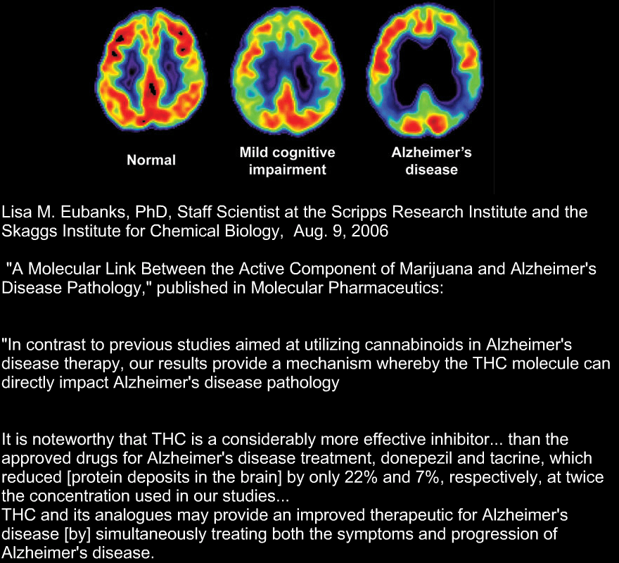 THEMMEXCHANGE's tweet photo. Cannabis and Alzheimer's

#marijuana #cannabis #Alzheimer #medicalmarijuana #hempoil #cbd #Thc http://t.co/SjTEVCPKf3
