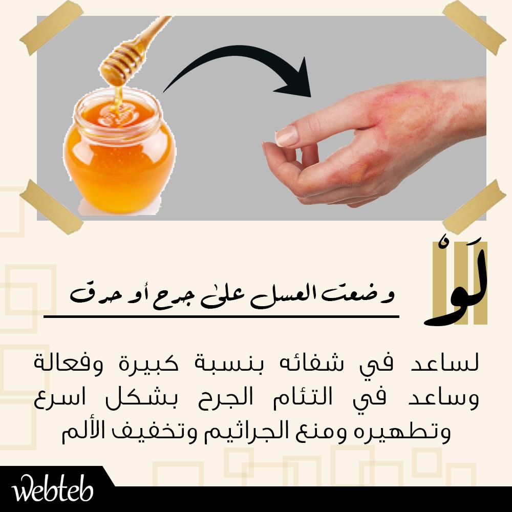 WebTeb_com's tweet photo. جرح أو حرق؟ عليك بالعسل! http://t.co/7SriNlEYRk