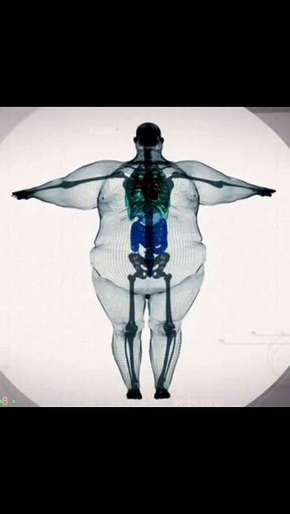 FixUrNutrish's tweet image. #wheretheveggiesat?