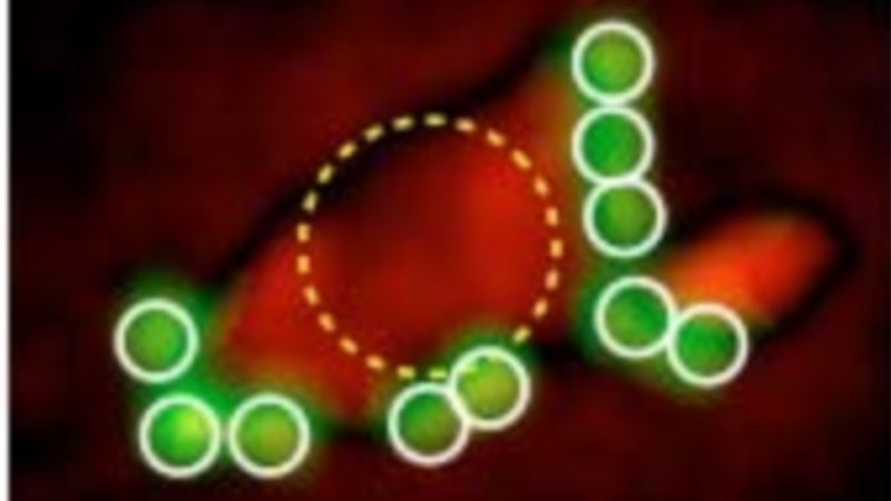 360daynews's tweet photo. Smartphone-based Device Detects Cancer Cells http://t.co/zcT9ww2De9