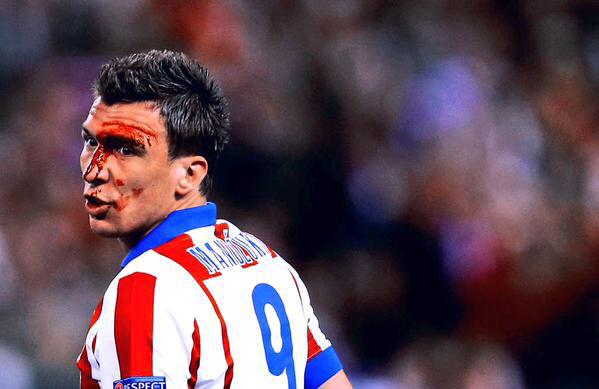 91minutosAtleti's tweet photo. El partido de Mandzukic en una sola foto. http://t.co/thT7b6iCmL