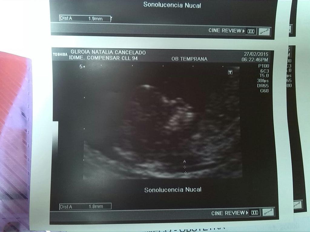 GSebas3's tweet photo. Mi bb http://t.co/IZkV21ayxw