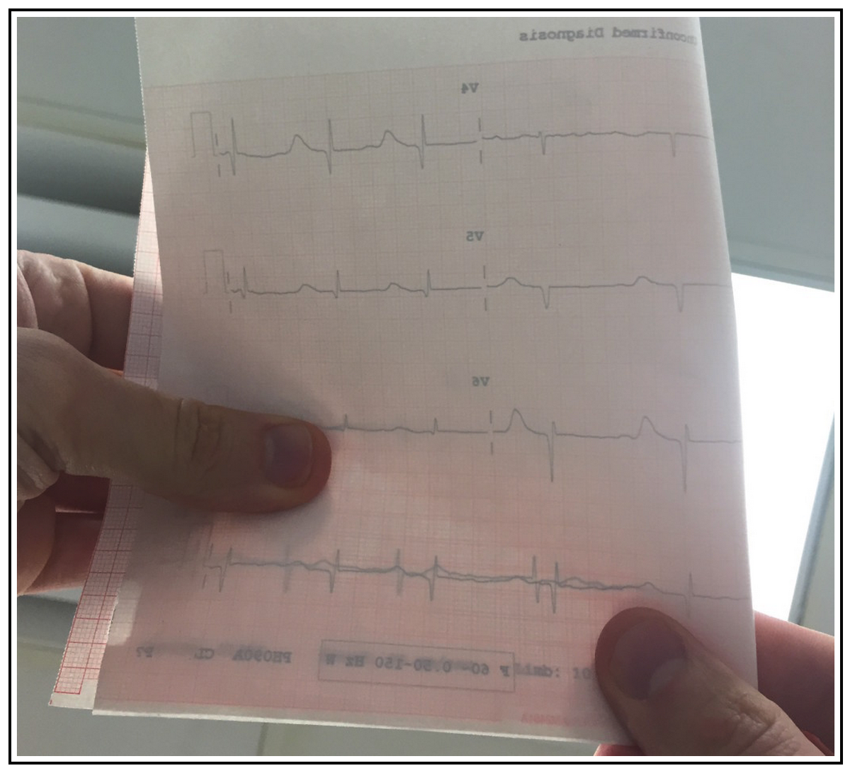 emupdates's tweet photo. How emergency clinicians determine regular vs. irregular rhythm, without instruments. 

http://t.co/QexmhkxB2T http://t.co/FWxHzG33cY