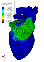 3DS_SIMULIA's tweet photo. Excited @intrinsys is showing the Living Heart Project at the Engineering Simulation Show!  #LivingHeartProject http://t.co/ZxtZNsUT9p