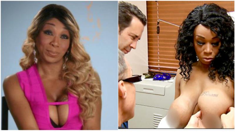 Tiffany "New York" Pollard Appeared On 'Botched' To Fix...