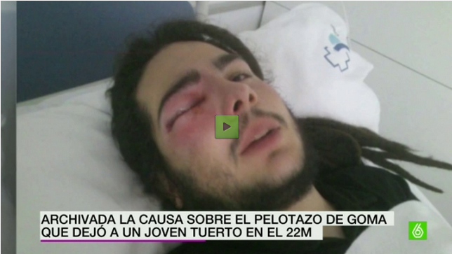 shul_evolution's tweet photo. Te dejamos tuerto xq sabemos q se archivará la causa. Así es España.
#Represión #impunidad

 https://t.co/ru1tOsxG9A  http://t.co/cpxqm1RMIN
