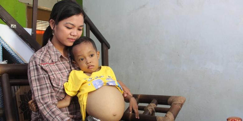 Perut Terus Membesar, Bocah 4,5 Tahun Ini Pun Tak Mampu Berjalan kom.ps/AFrhPy