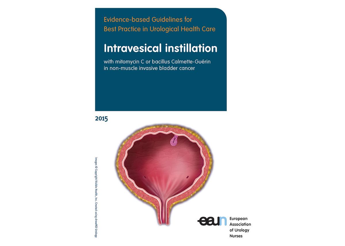 New Guideline for Nurses: Intravesical instillation nurses.uroweb.org/guideline/intr…