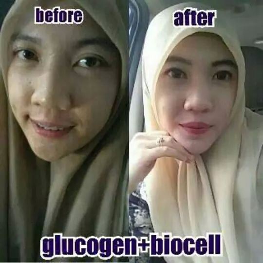 chenzs's tweet photo. Cream pemutih kamu bisa kayak gini gak ? Bisa merata permanen sekujur tubuh gini gak ? More info invite 54F20896 http://t.co/97kGPx43iM