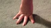 margaret_mcc1's tweet photo. This is what happens when adolescents spend to much time on their phone! RIP to meghan's thumb #prayer4prayer http://t.co/fUzpg0E1eL