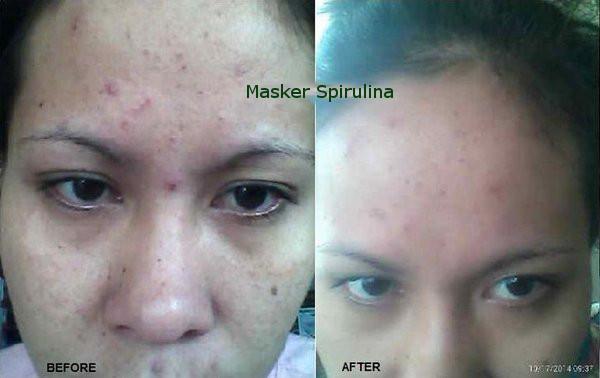 MaskerTiens's tweet photo. Jerawat di jidat emang bikin ganggu! Makanya, atasi dengan yg ALAMI | pin:282586A0 / 08973000503 @MaskerTiens http://t.co/ThhoRk0d5C