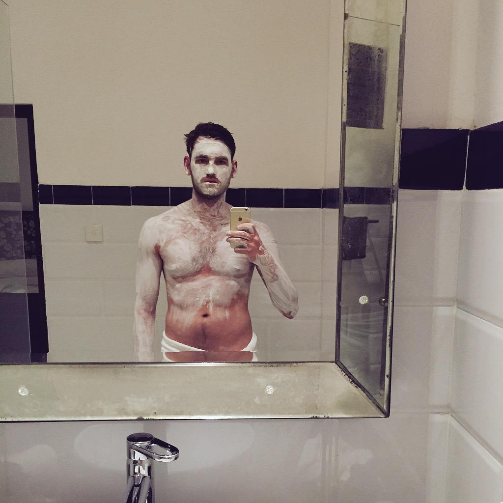 Pasha_Mickey's tweet photo. То чувство, когда обгорел 😑 http://t.co/elVBQib2bj