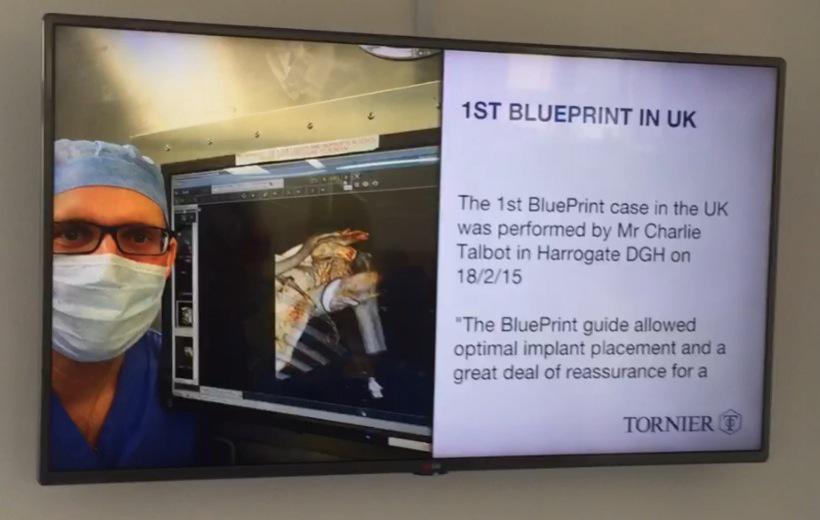 HarrogateSC's tweet photo. From #Tornier TV! http://t.co/0ytATCKFKZ