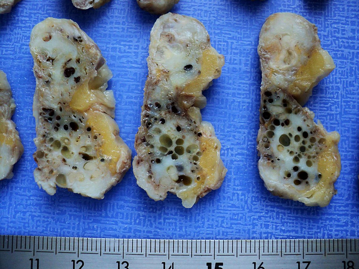 Nejib Ben Yahia, MD tweet media