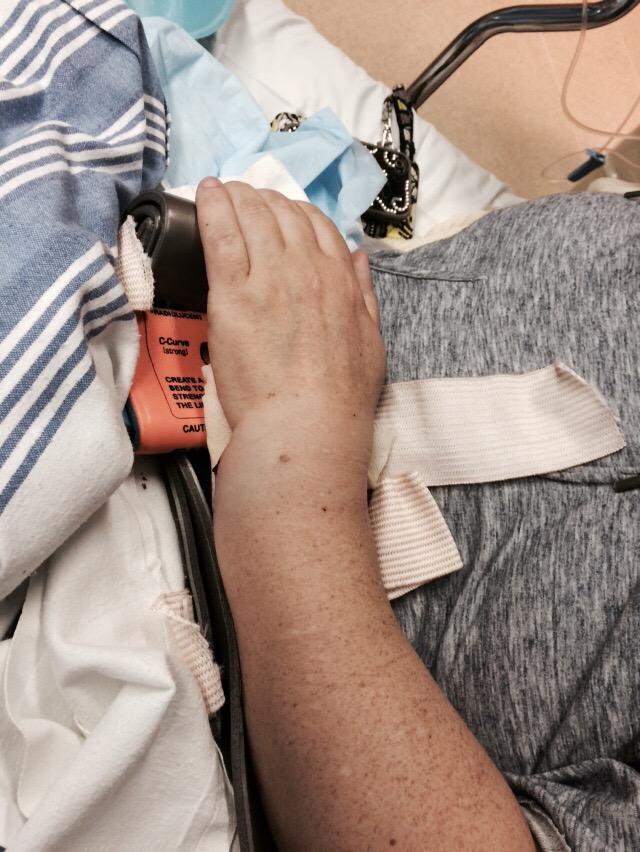 Friend of mine tumbled down the stairs. Looks gnarly. #settingit #propofol #fentanyl #iwantsome