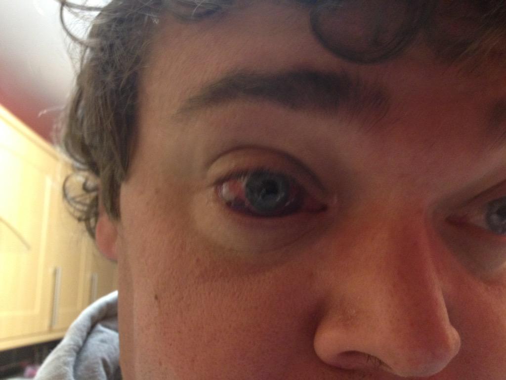 falcor2603's tweet photo. #bigneedleintheeye http://t.co/KC7K7sIyq4