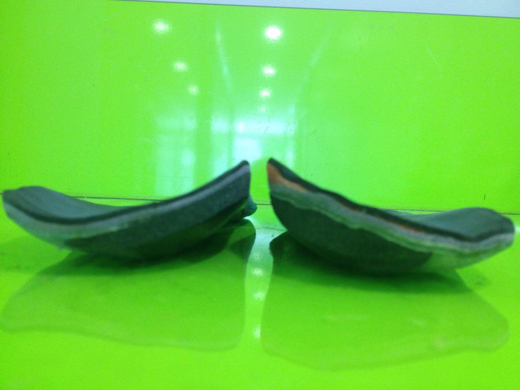 carlesrdguez's tweet photo. El día que a una insuficiencia de tibial posterior le presentaron un supinador-contención medial, mejoró! #podologia http://t.co/3qRFlZUljR