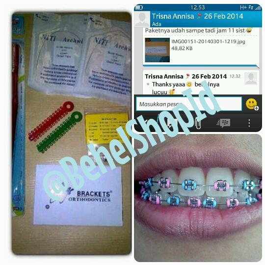 BehelShopID's tweet photo. "Behelnya lucu" 😁
Behel Permanen Metal
FREEOGKIR!
ORIGINAL!
Tinggal pasang k dokter
450~>200rb aja
mau?
inv 55381d46 http://t.co/gXvpEUMwxv