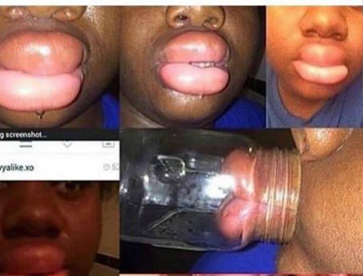 CarterSahra's tweet photo. Les babtou ils aiment trop nous dessiner avec des lèvres comme ça 😂😂😅 http://t.co/KL8sjFtlIe
