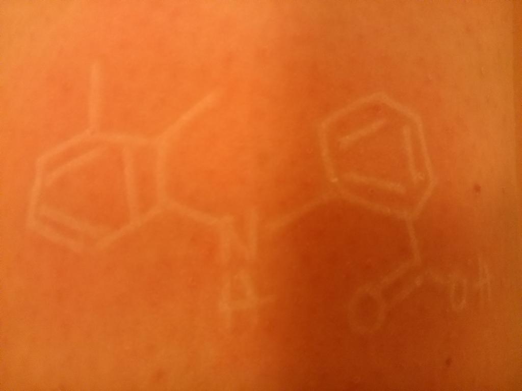 DrZoeWaller's tweet photo. #drugoftheday #Mefenamic acid non-steroidal anti-inflammatory drug used to treat menstrual pain #dermatographia http://t.co/cRJhYfdHmj