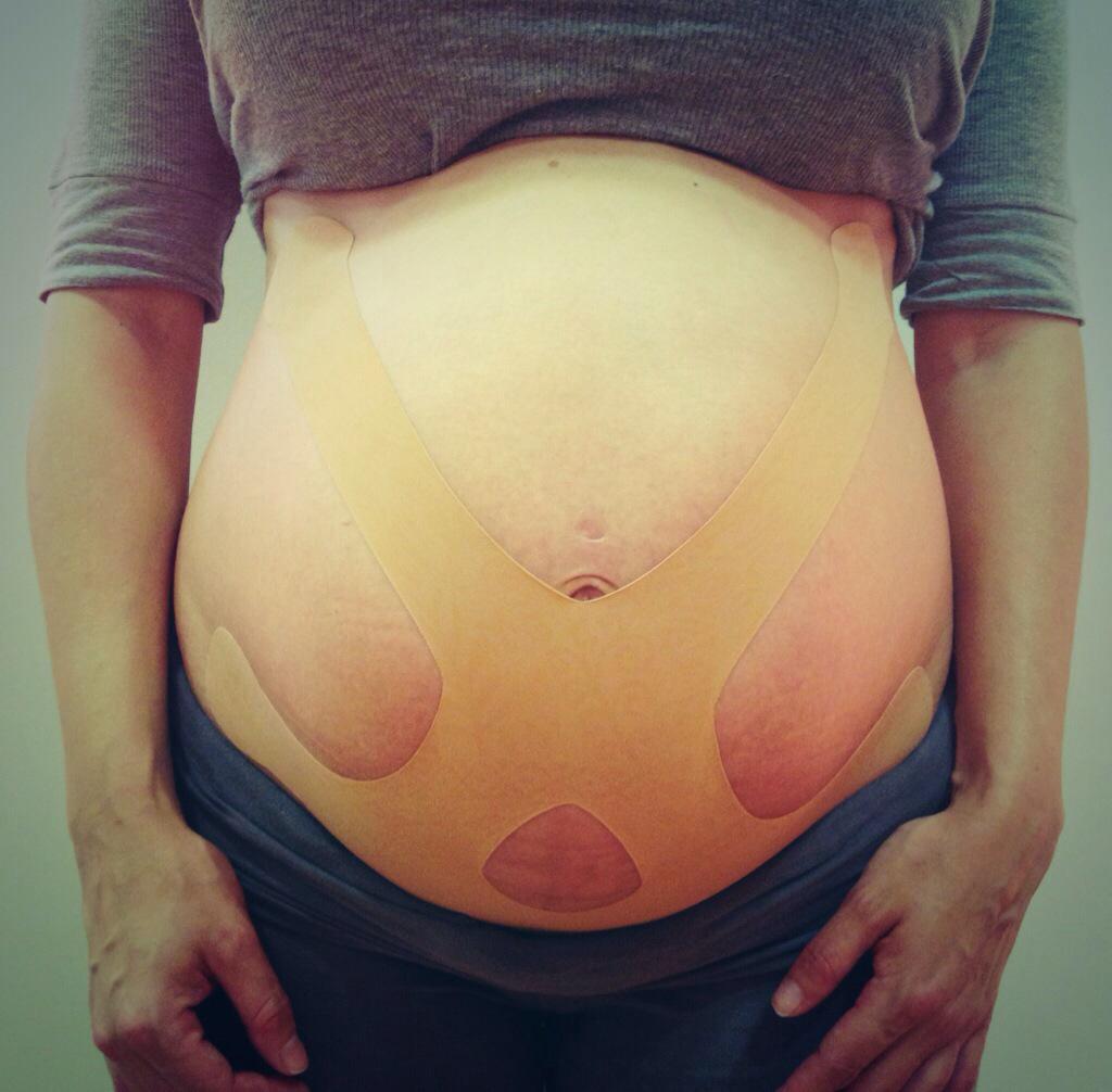 SofiaSanchezFIS's tweet photo. #Posturepals en la semana 37 de embarazo, 37th week of pregnancy #vendajebiomecánico @dynamictape @DYNAMICTAPEESP http://t.co/GaaGNxRBdw