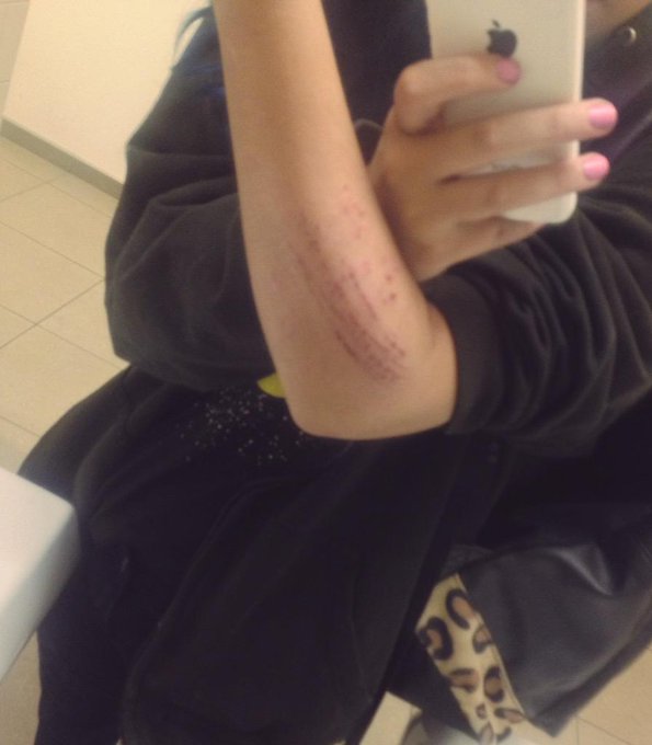 Fell in a bush hmu http://t.co/JZBtNPjrCP<a href="/tag/wishlist"class="tags"><span>#wishlist</span></a>