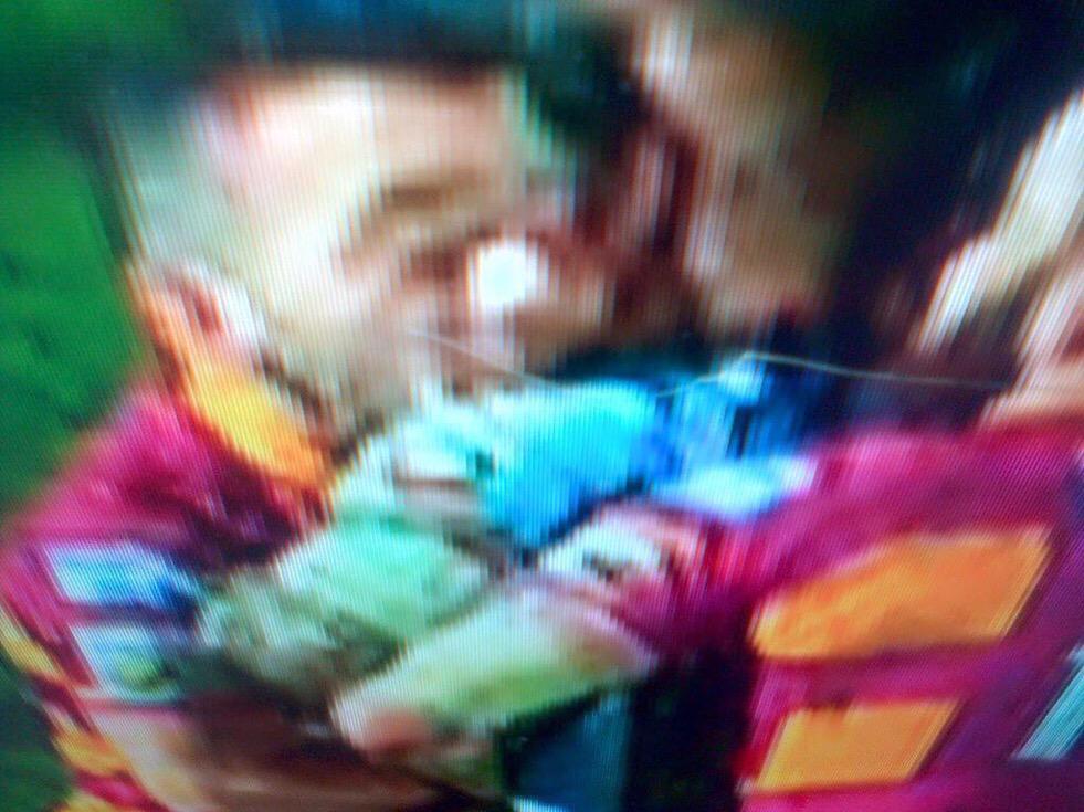 RhinosFaithful's tweet photo. Get these in your report.. Biting from Connor to Hardaker.. @SilversRef http://t.co/5KpwDorKe9