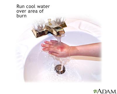 IgniteTorches's tweet photo. @AMAConfessions Fitting #amasummit http://t.co/zk1yA3BH4h
