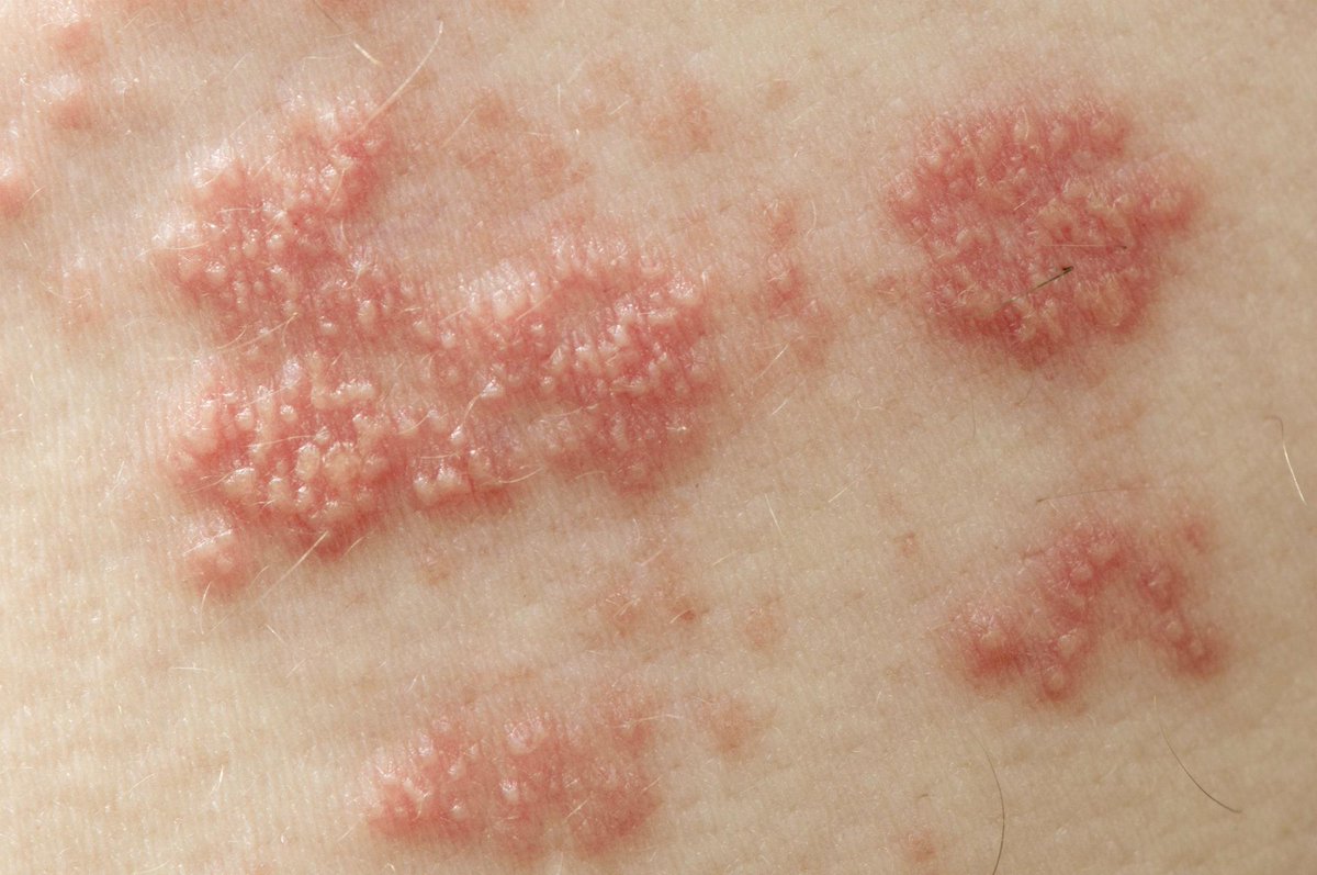 ClevelandClinic tweet picture