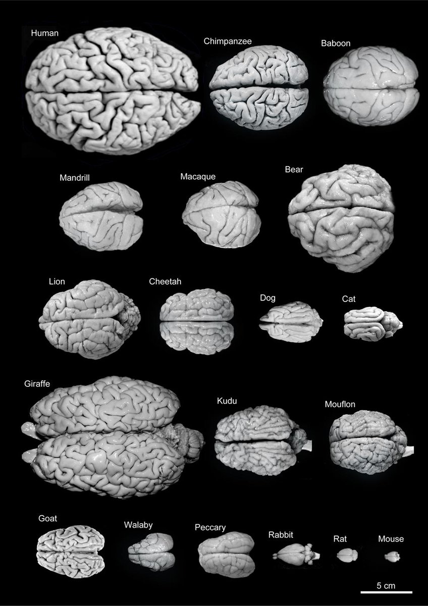 FrontiersIn's tweet photo. @FrontiersIn Related: this pic from Frontiers in #Neuroanatomy went viral last week. Study: http://t.co/zv90P7GLdT http://t.co/Hfhlx5xkAU
