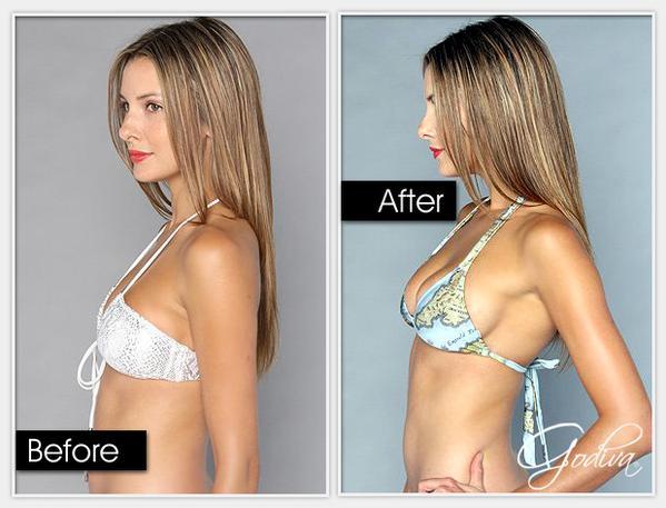 FlTNESS_365's tweet photo. This All-Natural Cream Is Scientifically Proven To Make Your Boobs Bigger http://t.co/PMsY2v3J5D http://t.co/4Rpsg0CdEb