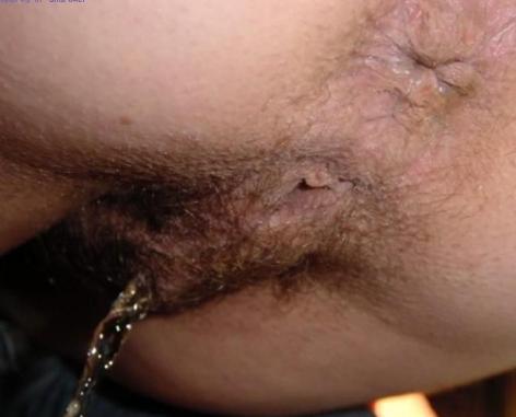 Rough pee hairy trans