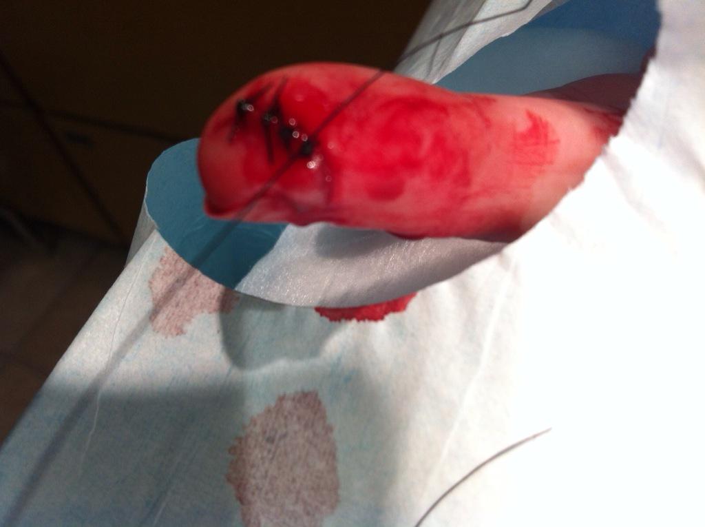 ProEggExpert's tweet photo. Been in A&amp;E all mornin! Nowt worse than catchin ye cock in ye zipper after a shit load of tins! Up side, #WeekOffWork http://t.co/RTzWShb8xo
