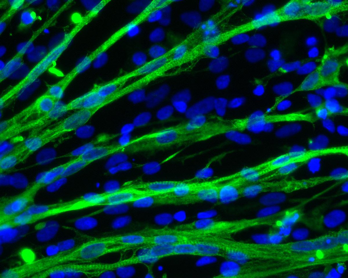 adMare_Bio's tweet photo. Apr 23 #Vancouver find out how muscle stem cells function and work. #stemcell http://t.co/l9CZ4UZzes #Pax7 http://t.co/798QCaJbLk