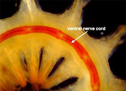 annelidaislife's tweet photo. I've told you I got a brain. mine just looks different. #itstheredpart http://t.co/pXTi7AjNee