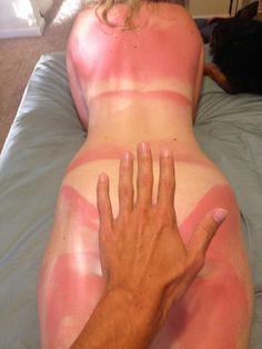 Getting baked, then "twice baked" after falling asleep in the sunshine #420Regrets <a href="/midnight/">After Midnight</a>