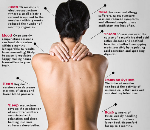 Prevention Mag's 10 reasons to try acupuncture... it's a great start! bit.ly/1J6woZX