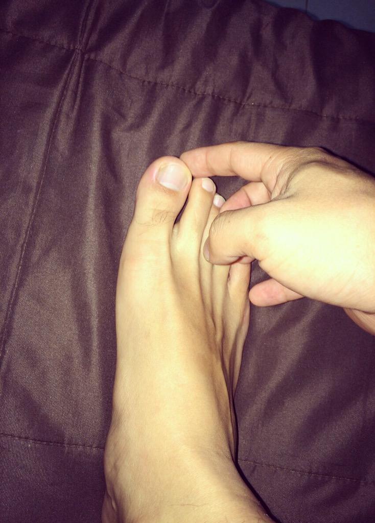 joy1982919's tweet photo. hurt my toe http://t.co/roJFCHWXeW