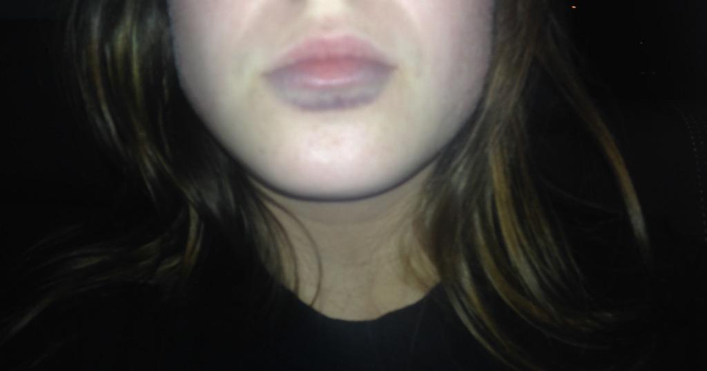 For any one thinks it would be funny to do the kylie Jenner thing don't !!