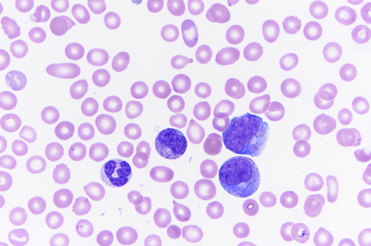 Kristie White, MD tweet media