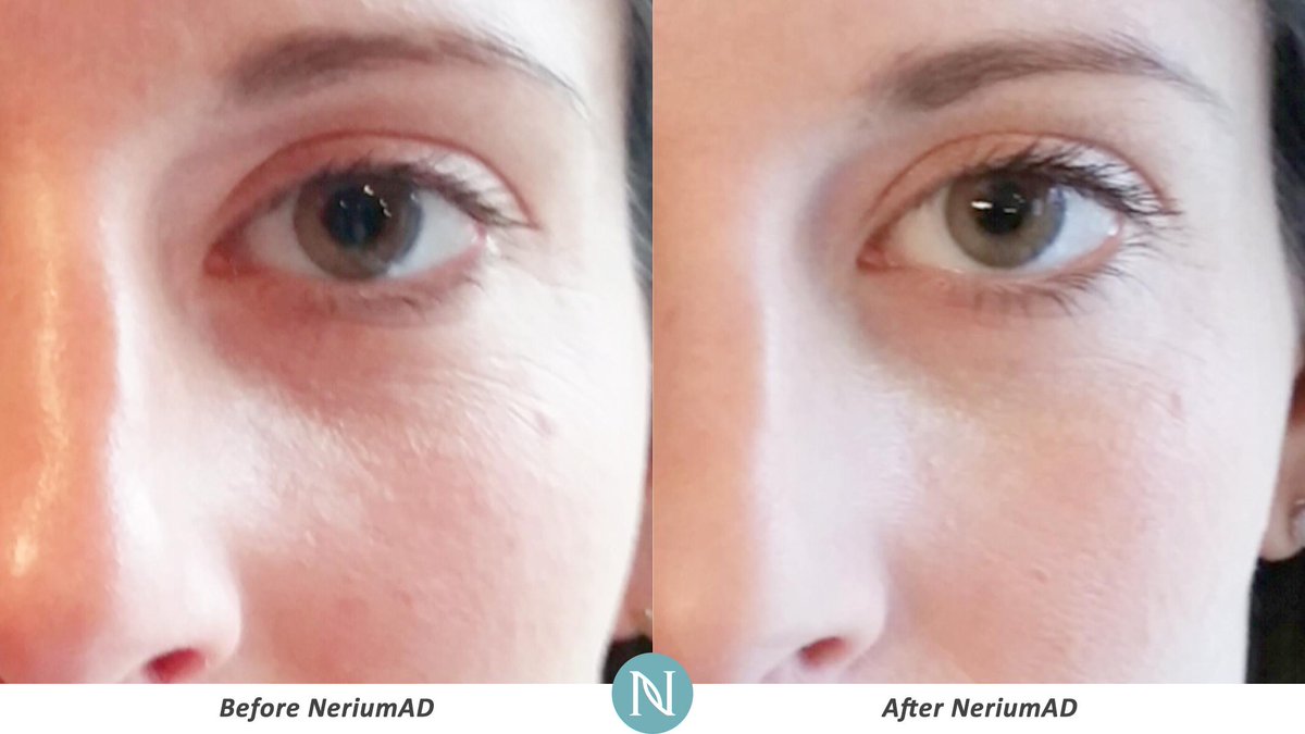 jparker0424's tweet photo. Nerium is the secret to ageless skin. Join now! http://t.co/4z13hCB81Z