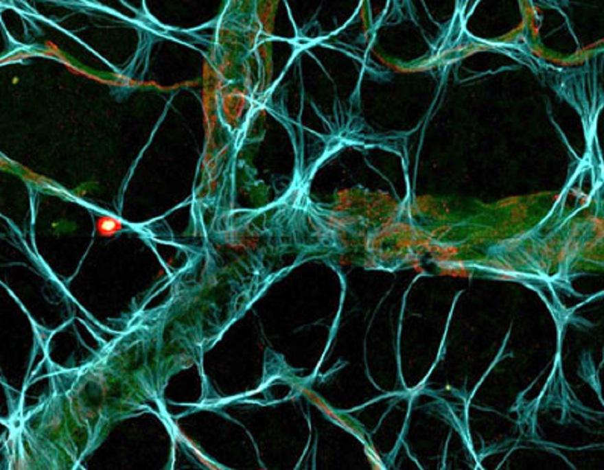 Novartis's tweet photo. Eyeing the blood barrier in the back of the eye. http://t.co/ZqbMduFLur #SciencePic #retinopathy http://t.co/AMJNR6vTmX