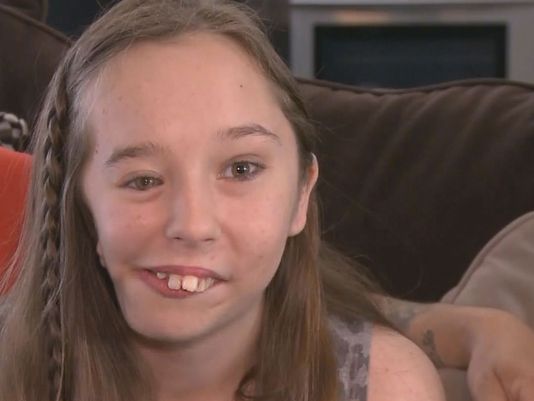 Bullied Girl With Goldenhar Syndrome All Smiles After Outpouring Of