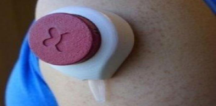 Techworm_in's tweet photo. A new Blood collection device will replace the painful needles http://t.co/gTzoQPWdhY http://t.co/vUF7ODWh9c
